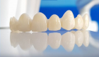 Răng sứ Orodent Dòng răng sứ thẩm mỹ đến từ Ý an toàn nhất thế giới